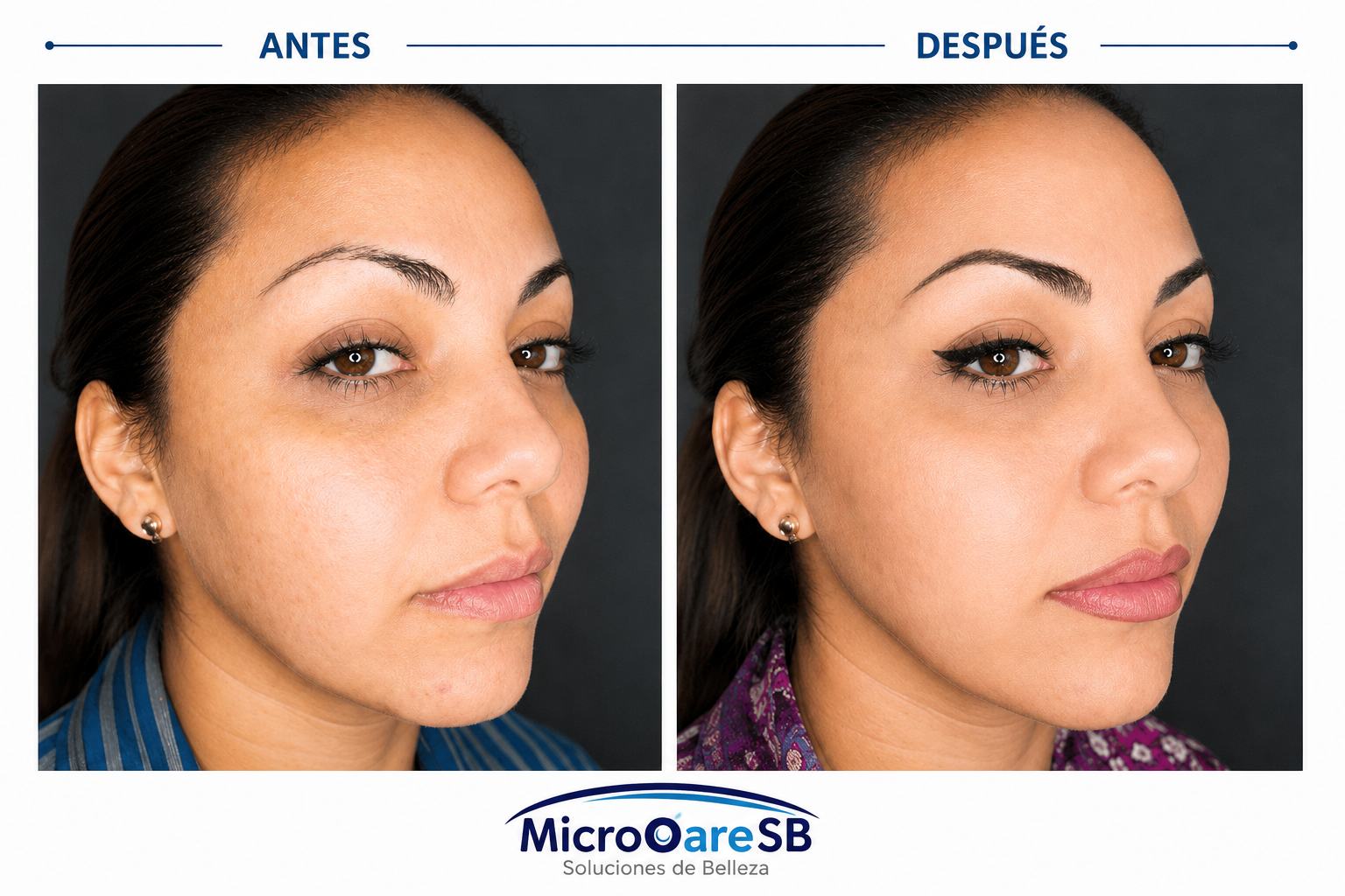 Transformación total